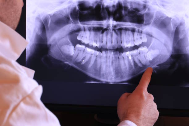 Best Emergency Dental Care for Trauma or Injury in Mayville, ND
